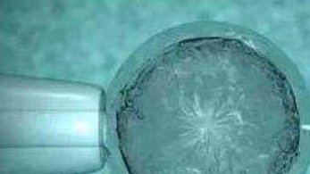 2026年在上海中医药附属曙光医院做三代试管贵吗？钱都花到了哪些地方